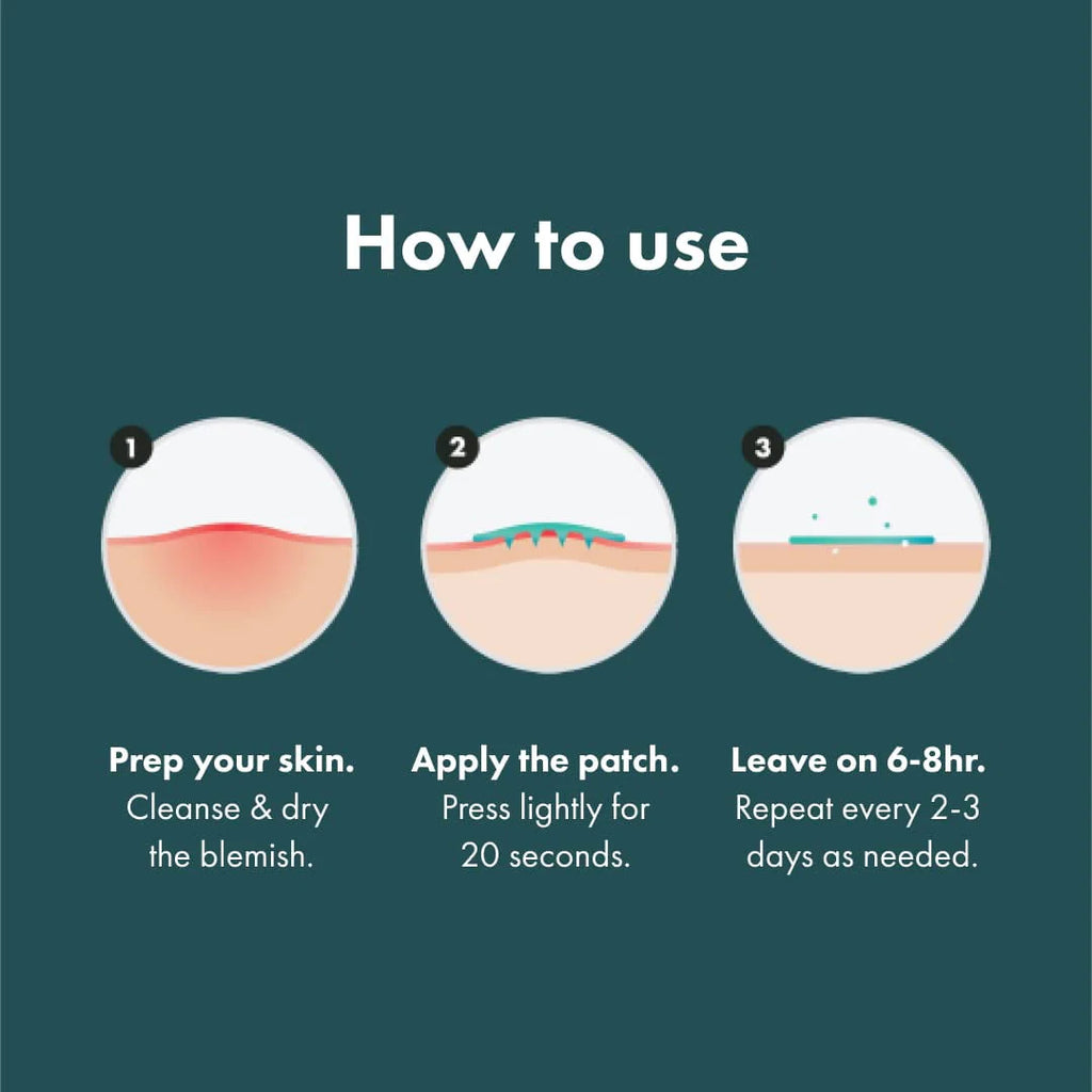 Hydrocolloid Acne Spot Treatment Patch 8 Patches U855266